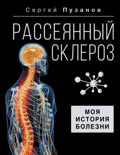 Постер книги Рассеянный склероз. Моя история болезни